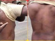 छिंदवाड़ा: आदिवासी युवक से हैवानियत, मुंह पर थूका और पिलाई पेशाब, मार–मार कर चमड़ी उधेड़ी, क्षेत्र में तनाव